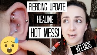 UPDATE Snug amp Rook PIERCINGS  1 Month  Not Going as Planned [upl. by Deming578]