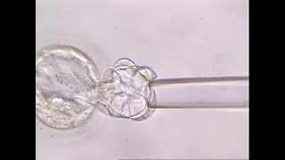 Biopsia del Embrión en día 5 en fase de Blastocisto [upl. by Etnovahs485]