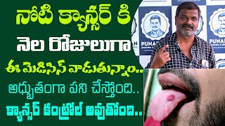 Mouth Cancer Patient Survival Story  Successful Cancer Treatment  Dr Bommu  Punarjan Ayurveda [upl. by Suivatnom629]