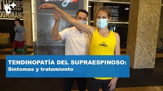 Tendininitis del supraespinoso qué es y qué hacer  CuídatePlus [upl. by Coney236]