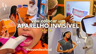 vou colocar aparelho INVISÍVEL✨ sousmile skan 3D… [upl. by Schoenfelder]