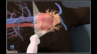 How To Apical 4Chamber View Echocardiography 3D Video [upl. by Neeluj]