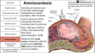 Prenatal screening fetal testing and other tests during pregnancy [upl. by Rickert]