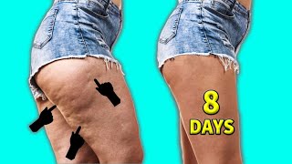 8 DAYS TO GET RID OF CELLULITE FROM THIGHS HIPS amp LOWER BELLY [upl. by Sands]