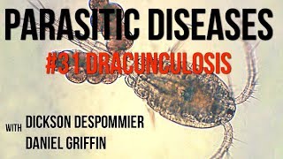 Parasitic Diseases Lectures 31 Dracunculosis [upl. by Sunny]