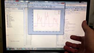 RealTime EMG Signal Processing  Live Muscle Activity Analysis [upl. by Parks]