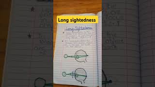 Long sightedness explained class eyes disease eye problem [upl. by Naaman]