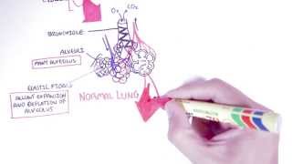 Emphysema  Introduction Types Symptoms Diagnosis [upl. by Leorsiy]