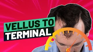 Vellus Hair to Terminal Hair  How to Speed It Up [upl. by Uah722]