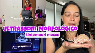 Fiz Ultrassom Morfológico do 1° Trimestre com 13 Semanas Sintomas 4 meses e Escolhemos o nome dela [upl. by Ylesara102]