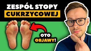 Powikłania cukrzycy STOPA CUKRZYCOWA  Objawy które muszą znać osoby z cukrzycą  Nie słodzę [upl. by Jenkins531]