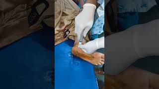 INTRAARTICULAR INJECTION FOR ANKLE PAIN [upl. by Delmore]