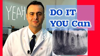 Secrets of Mastering Calcified Molar Endodontics [upl. by Airet]