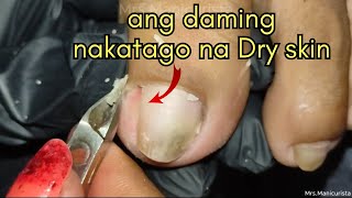 Vlog 992Dry SkinIngrown Removal PEDICURE 892 [upl. by Washington]