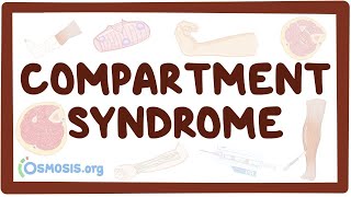 Compartment syndrome  an Osmosis Preview [upl. by Acirne]