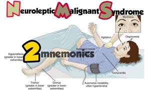 neuroleptic malignant syndromefeatures treatment  NMS [upl. by Edrick]