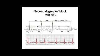 03 ECG Practice [upl. by Laurinda677]