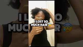 Hair Regrowth with Home remedies 🥹 shorts naturalhair tractionalopecia [upl. by Ecissej862]