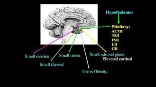 Excitotoxins Neurotoxins amp Human Neurological Disease Lecture  Dr Russell Blaylock [upl. by Danyelle893]