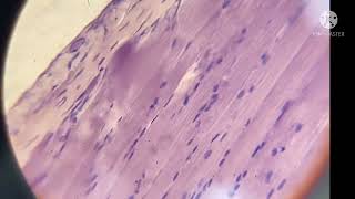 Muscle Histology Microscopic view  histology slide of Muscle Skeletal Cardiac Smooth Muscle [upl. by Corson]