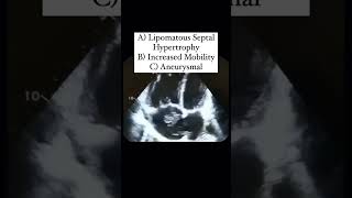 Interatrial Septum Quiz echocardiography [upl. by Innad591]