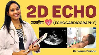 2D ECHO Echocardiography Test की पूरी जानकारी  2D ECHO test Details [upl. by Stephan552]