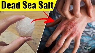 Dead Sea Salt Benefits  Where to Buy Dead Sea Salt [upl. by Felicia356]