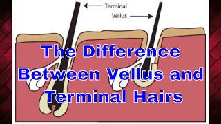 The Difference Between Vellus and Terminal Hairs  TheBeardnecessities  Ep 33 [upl. by Ree]