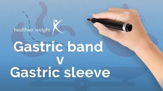 Gastric band vs Gastric sleeve [upl. by Edeline485]