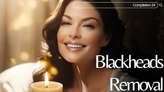 Skincare  Blackheads Removal 024 blackheads skincare [upl. by Georg563]