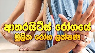 ආතරයිටීස් රෝගයේ මුලික රෝග ලක්ෂණ ayurveda arthritis arthritiscure arthritistreatment [upl. by Joelly]