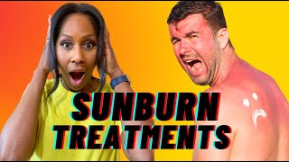 How to GET RID of a SUNBURN FAST A Doctor Explains [upl. by Parlin]