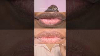 Dark lips remedy naturalremedy malluvlogger malayalambeautytips malayalambeautychannel lipcare [upl. by Joappa]