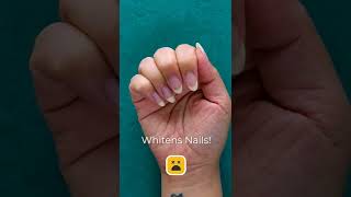 How to whiten your nails shorts [upl. by Essilec90]