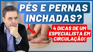 Pés e pernas inchadas  Causas e 4 dicas importantes  Dr Alex Vascular [upl. by Anaj]