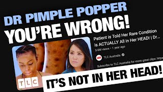 Calling Out Dr Pimple Popper  Mysterious Rash Prurigo Nodularis [upl. by Nerok876]