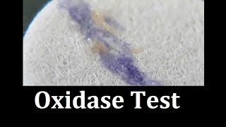 Oxidase test Protocol [upl. by Aneahs]