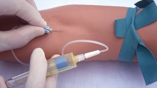 Performing a venipuncture using a butterfly needle [upl. by Trent368]