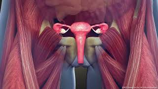 What is Intramural Uterine Fibroid Symptoms and Treatment  3D Guide [upl. by Atse]