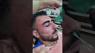 ازاله الدقن بالشمع 💈✂️😂😂 fun funnyvideo funnyshorts funny viralvideo fyp [upl. by Zacharias223]