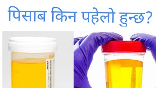 Yellow colour urine In NepaliDr Bhupendra Shahdoctor sathi [upl. by Kaazi967]