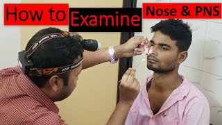 Clinical Examination of Nose amp Paranasal Sinuses Step by Step Demonstration [upl. by Otnicaj775]