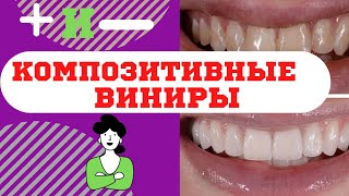 quotКомпозитные виниры Мой опыт [upl. by Garrick]