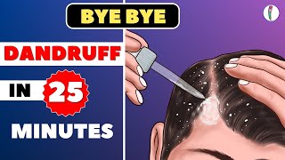 🔥1 Dandruff Treatment at Home  How to get rid of Dandruff  Dandruff Removal  Itchy scalp [upl. by Razaele830]