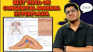 Congenital Adrenal Hyperplasia Pathology  NEET PG 2023 USMLE 2nd MBBS Best Video [upl. by Emelyne]