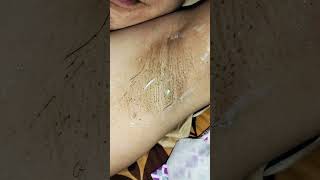 UNDER ARM HAIR REMOVAL CREAM EFFECTIVE NGA BA [upl. by Attolrahc]