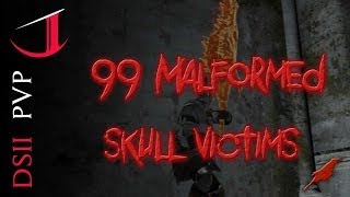 99 Malformed Skull Victims [upl. by Ad]