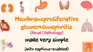 Membranoproliferative glomerulonephritis  MPGN  Renal system  Pathology  Med Vids made simple [upl. by Gervais]