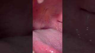 Mouth Tour short tongue uvula mouth teeth [upl. by Anircam]