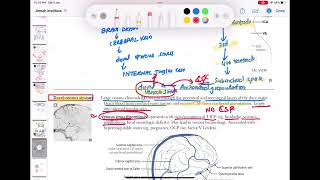 Dural venous sinuses anatomy and physiology neurology 43  First Aid USMLE Step 1 in UrduHindi [upl. by Bonni201]